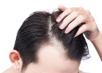 How To Get Painless Hair Transplant Treatment With Maximum Density