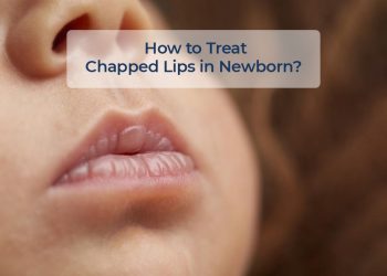 image with text how to treat chapped lips in newborn