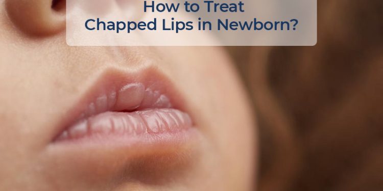 image with text how to treat chapped lips in newborn