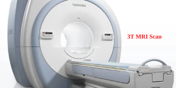 3T MRI Scan